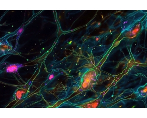 新的神经元可视化标记技术助力疾病的长期跟踪
