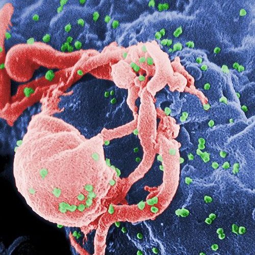 美科学家宣称：能找到杀死艾滋病毒的干细胞