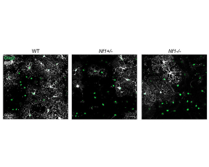 Nf1基因影响少突胶质细胞可塑性