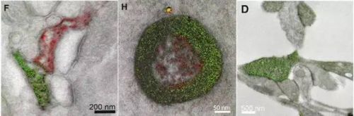 重大突破：电子显微镜拍出细胞彩照！